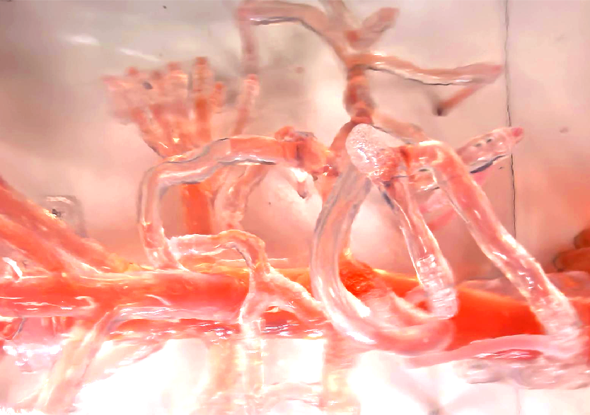 血管介入治疗模拟训练平台